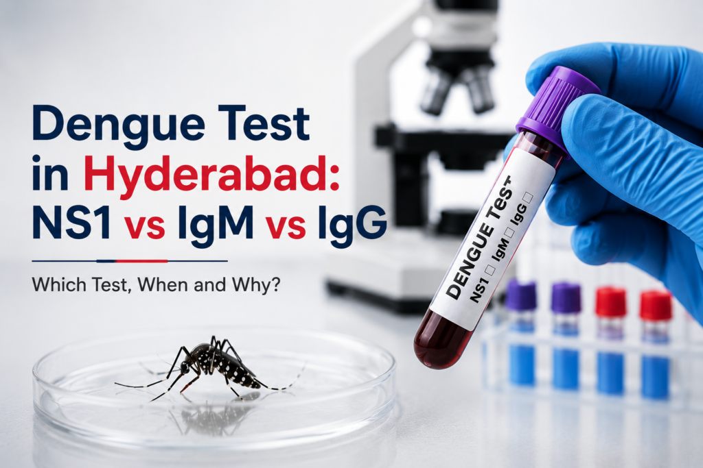 Dengue Test in Hyderabad – NS1 vs IgM vs IgG Blood Test | Lotus Diagnostics
