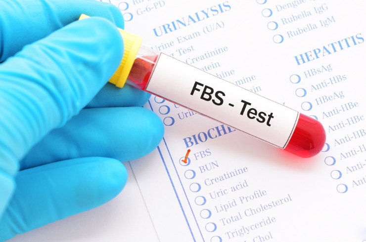 Fasting Blood S