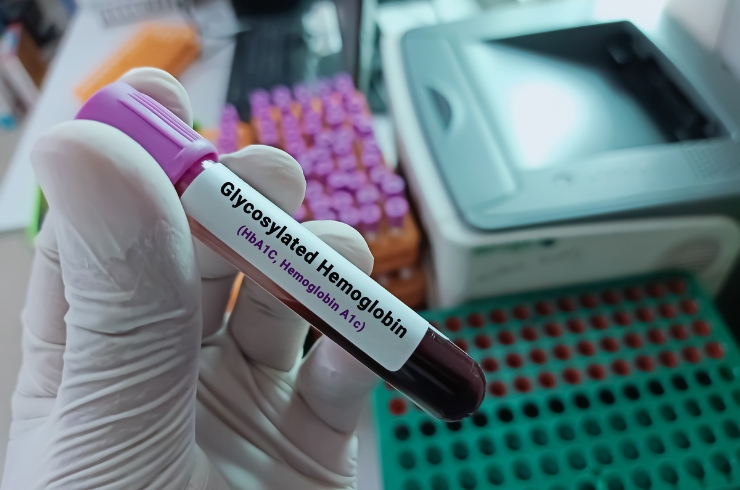 HbA1c (Gly