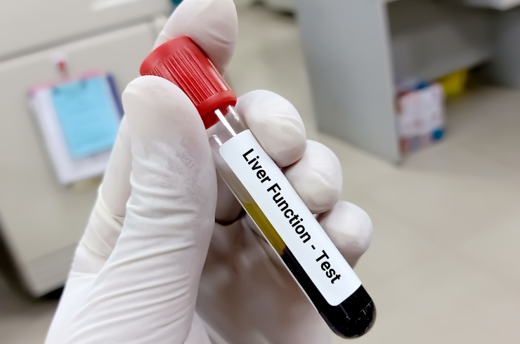 /liver-function-test/
