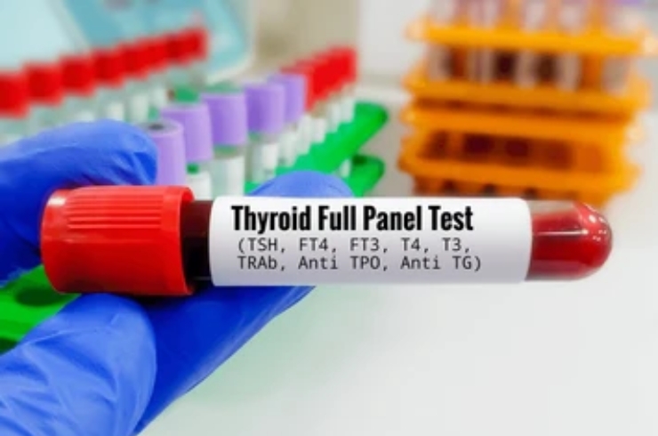 Thyroid Profile