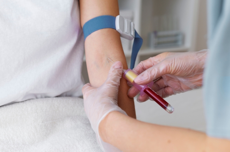 BLOOD-TEST-31
