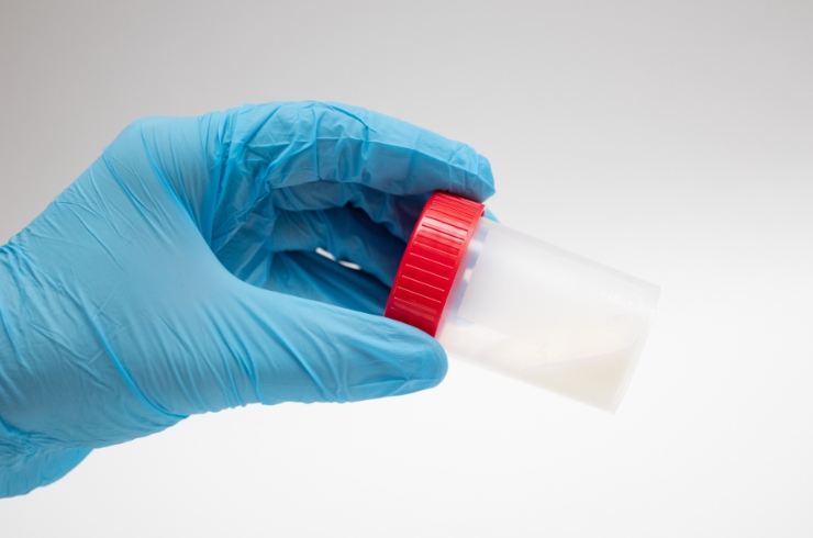 STOOL-TESTS-31