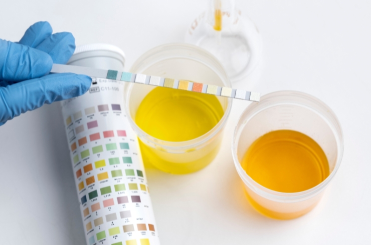 URINE-TEST-31