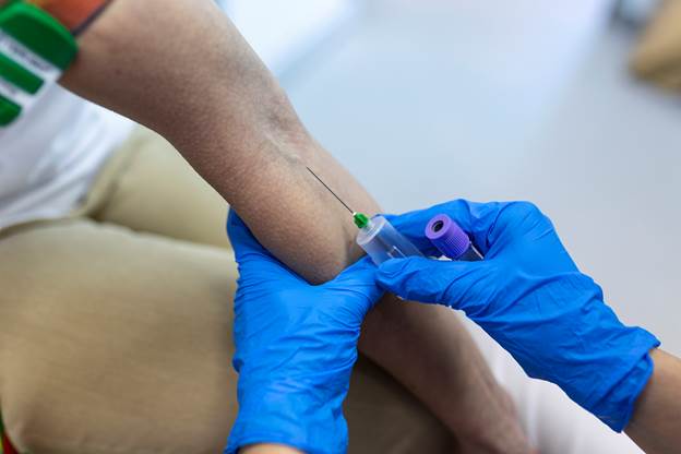 Vitamin D (25-hydroxyvitamin D) Test: What You Need to Know